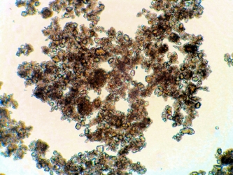 Bild 2: Mikrohabitat, mikroskopische Aufnahme Vergrößerung ca. 400x